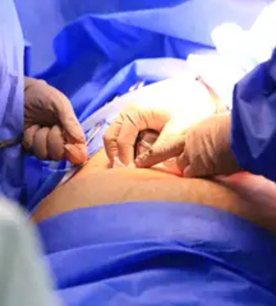 Nova técnica de quimioterapia para câncer de pâncreas é testada no Brasil 