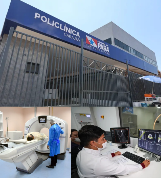 Saúde pública: Policlínicas descentralizam atendimento especializado no estado.