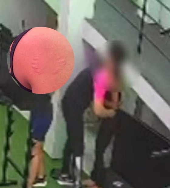 Professora denuncia instrutor de academia por agarrá-la e mordê-la durante treino no Recife